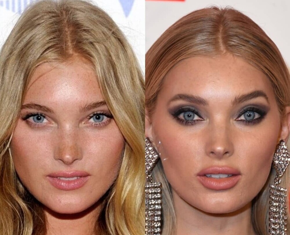 Красивые накаченные губы до и после фото