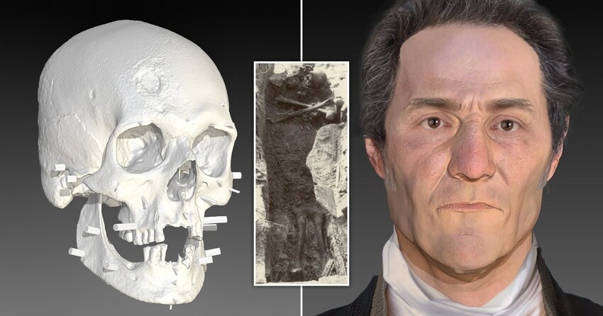 Ученые воссоздали лицо «вампира» 19 века, умершего от туберкулеза
