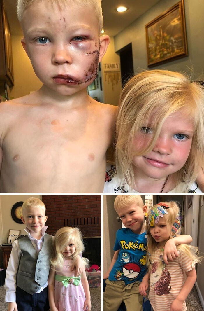 3. 6-летний мальчик защитил свою младшую сестру от нападения собаки. И сказал: "Если кто-то и должен умереть, так это я. Я старший брат"