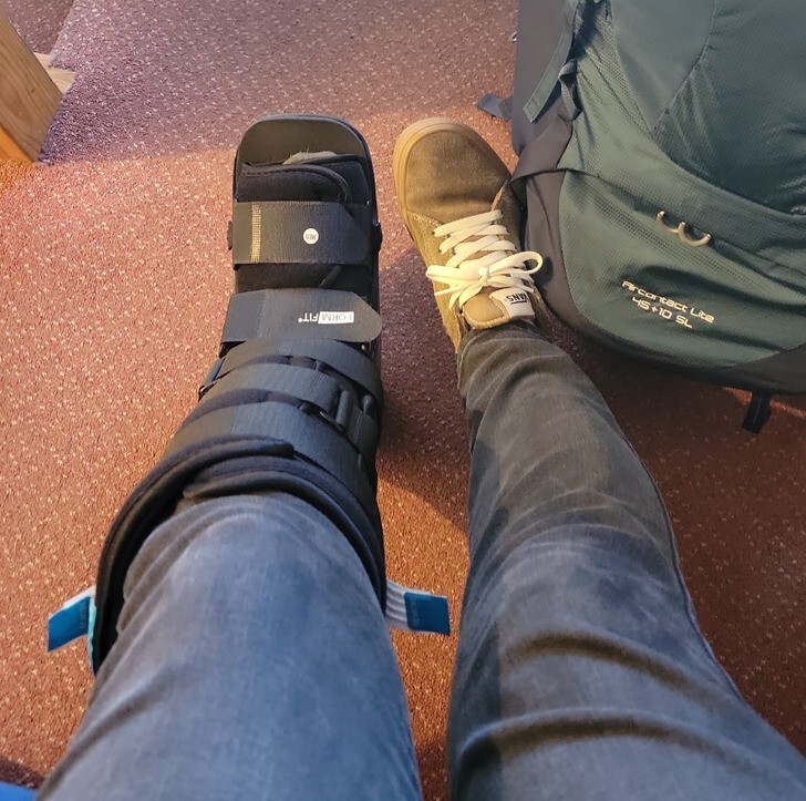 15. "Это я в ортопедическом ботинке на сломаную ногу на 7-й день из 24-дневного тура моей мечты по Великобритании"
