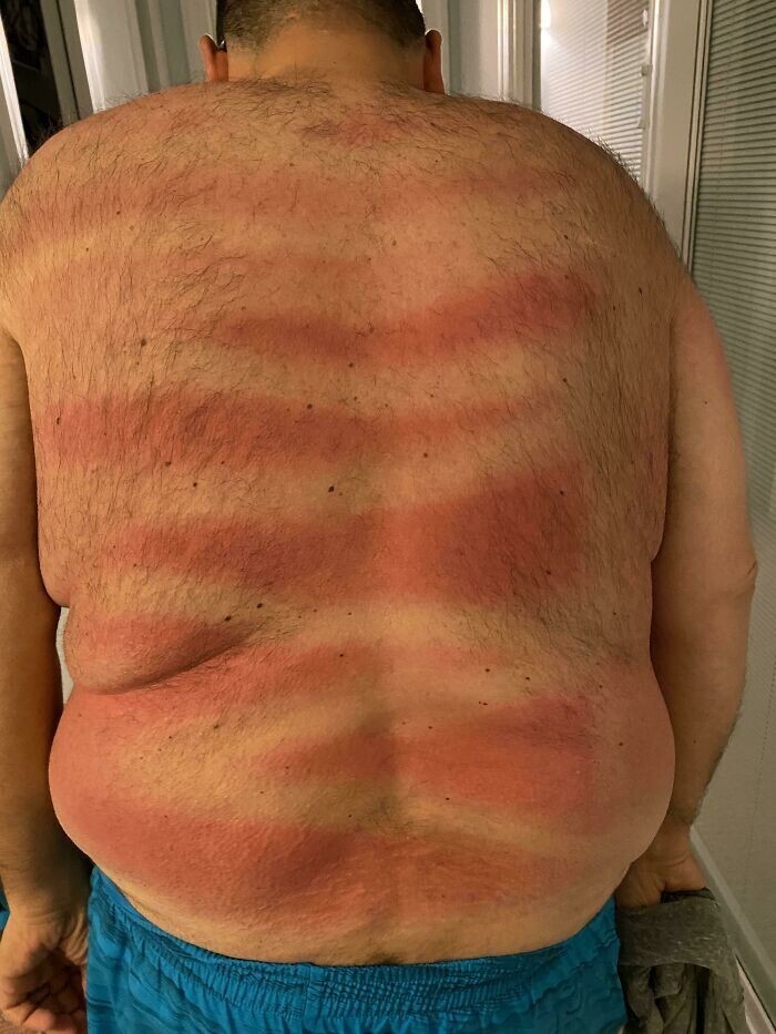 25. "Первый день на пляже, и моя жена позаботилась о том, чтобы я не сгорел, нанеся мне на спину солнцезащитный крем. Я там сзади не вижу - нормально она справилась?"