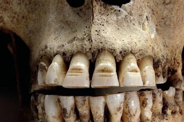 Череп викинга с обточенными зубами. Зачем они были обточены, неизвестно