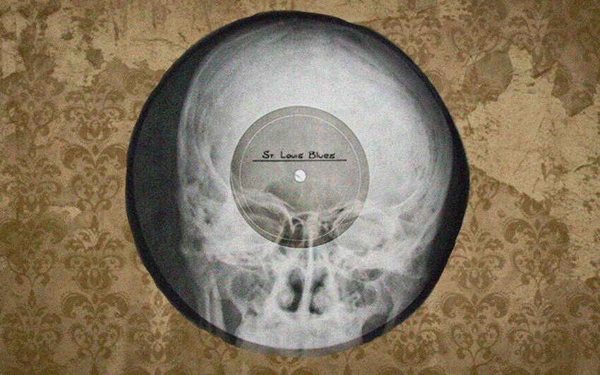 Как в СССР нелегально записывали музыку на рентгеновских снимках