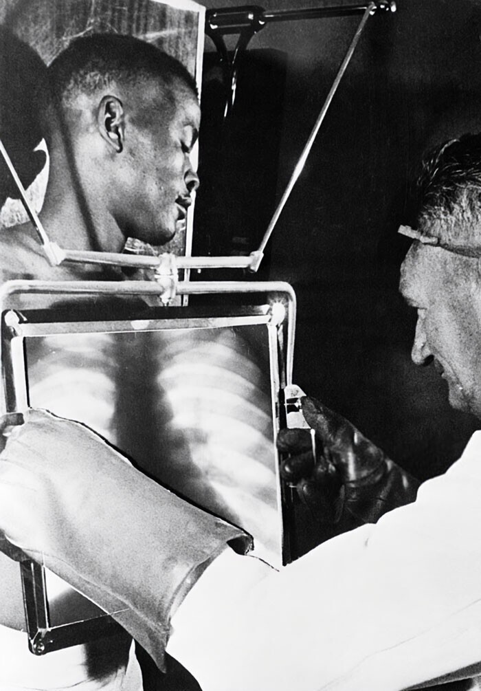 31. Каждый день в конце смены рабочие алмазных шахт должны были пройти через рентгеновский аппарат для проверки. Некоторые глотали алмазы и даже прятали их в надрезах на ногах. Южная Африка, 1954 год