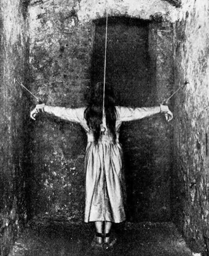 Пациентка психиатрической лечебнице во Франции во время процедуры, 1900-е