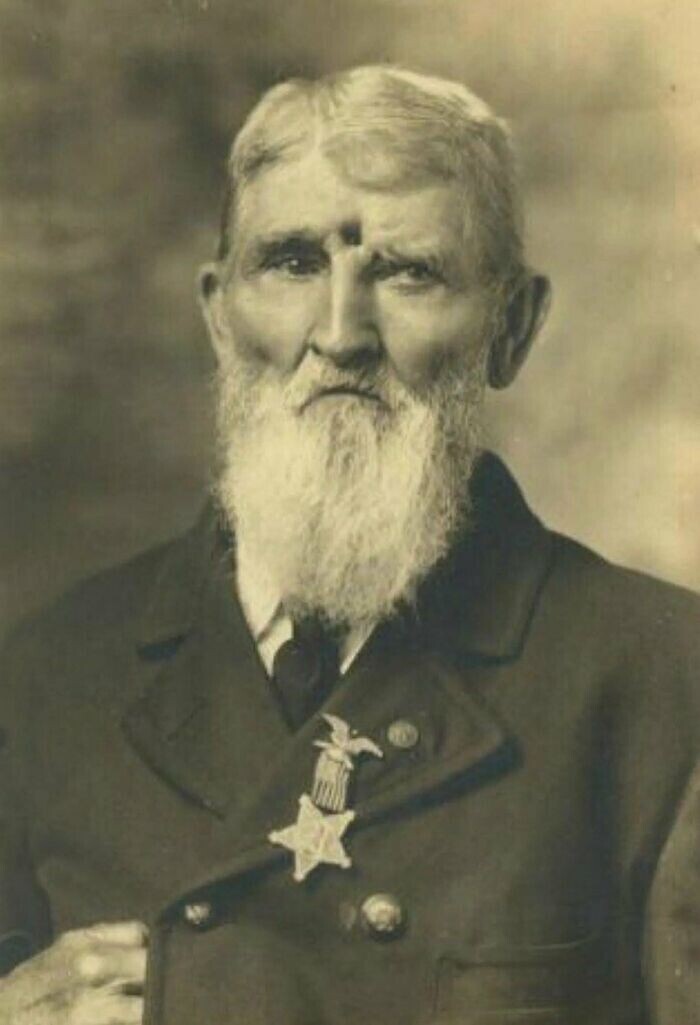 Джейкоб Миллер (1829-1917), человек, выживший после прямого выстрела в голову в Чикамауге в 1863 году