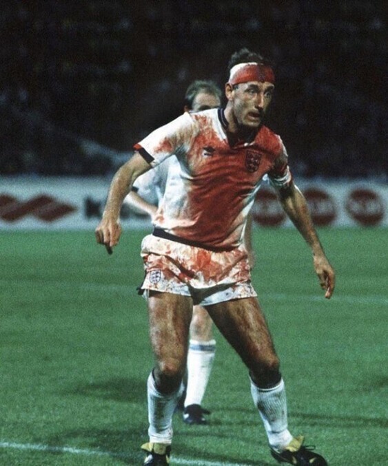Терри Батчер в крови, после ранения головы, участвует в отборочном матче чемпионата мира против Швеции, 1989 год