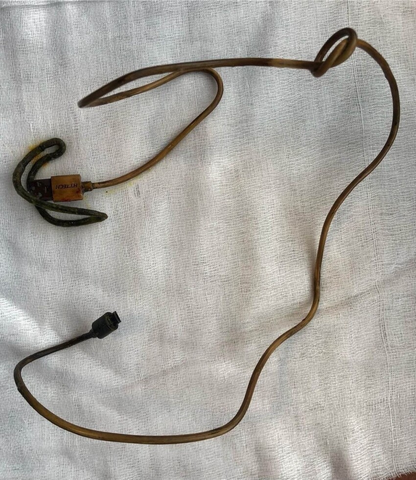 Врачи нашли в кишечнике подростка USB-шнур и резинку для волос