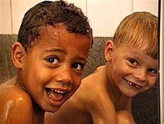 Как у белой пары могли родиться близнецы с разным цветом кожи