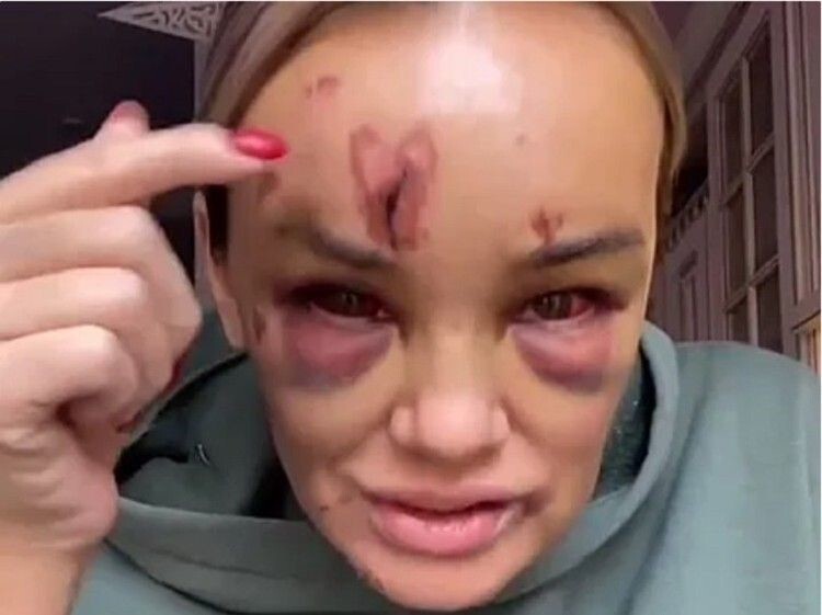 "Полиция есть, но пока она приедет, всем проломят голову": петербургскую блогершу на глазах у людей жестоко избили из-за замечания
