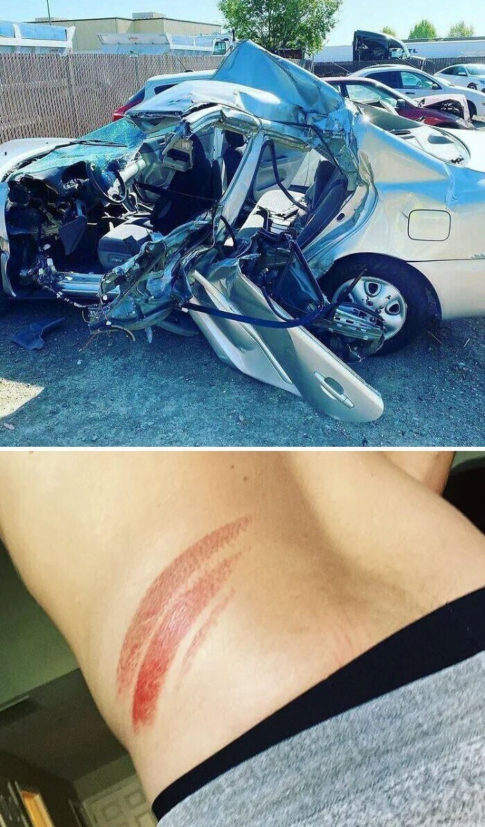 8. "Это машина моего друга после того, как его сбил полуприцеп. Следующее изображение — единственная травма, которую он получил"