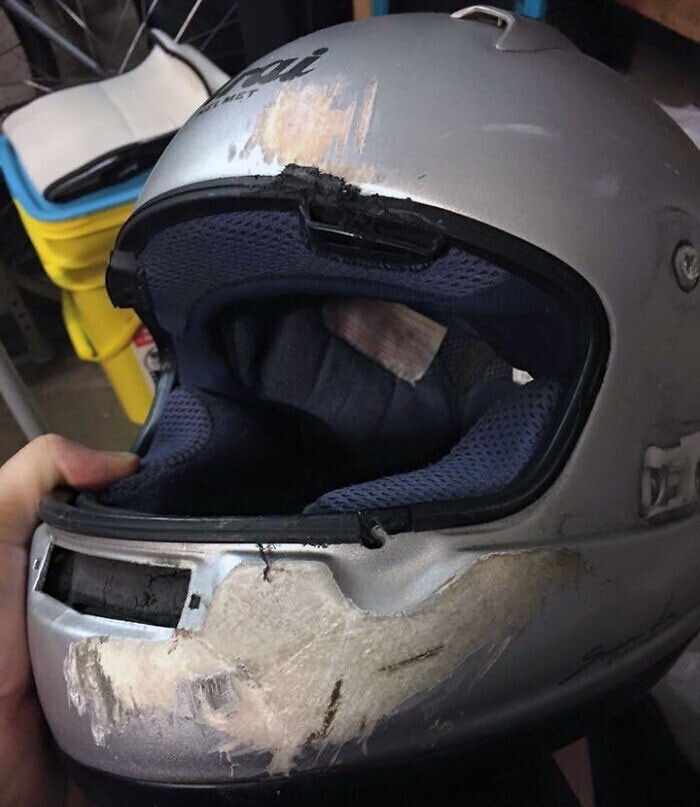 6. "Вот почему нужно носить полностью закрытый шлем. Моего друга сбил автомобиль, проехавший на красный цвет. Если бы не шлем, у парня не было бы нижней челюсти"