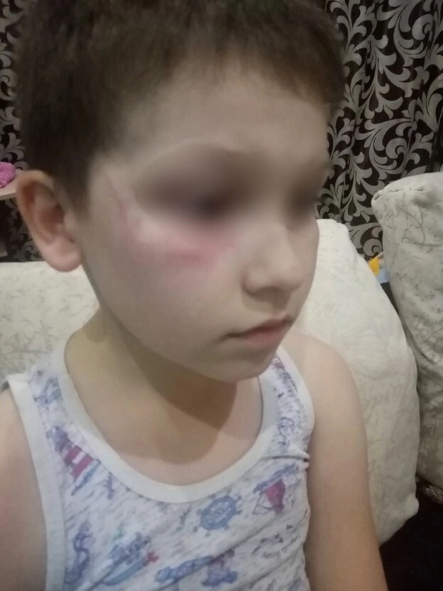 В Кировской области ребёнка избили из-за желто-синей "ватрушки"