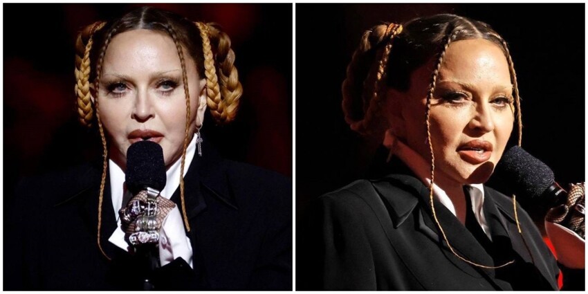 На премии "Грэмми" Мадонна показала своё новое лицо и подняла волну шуток в сети