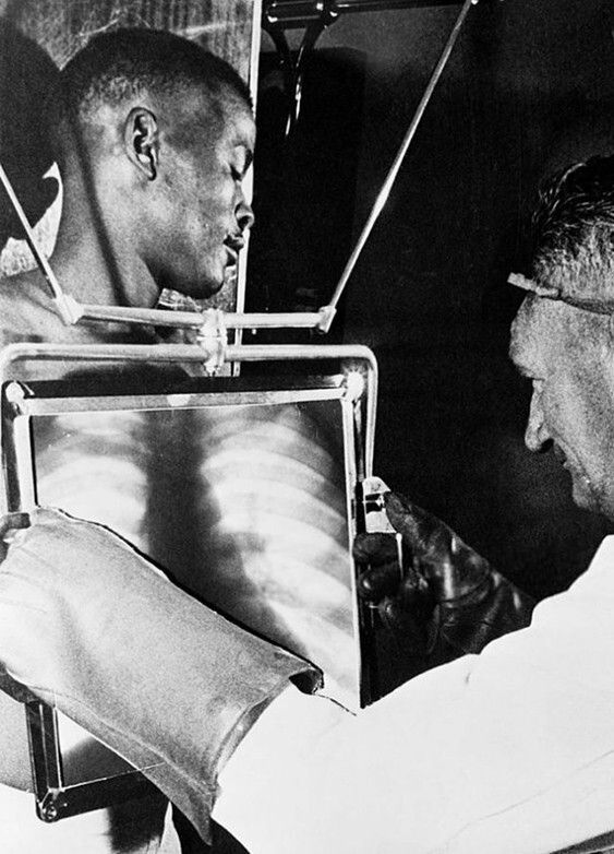 Рентгенолог проверяет желудок шахтера на наличие проглоченных алмазов, Кимберли, ЮАР, 1954 год