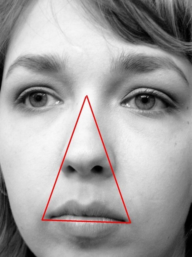 5. В редких случаях выдавливание прыща на лицевом треугольнике может привести к параличу или инфекции головного мозга