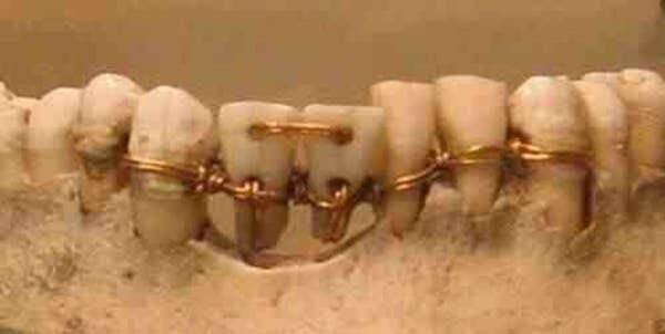 14. Модель того, как могла выглядеть работа стоматолога в Древнем Египте. Создана доктором Винченцо Герини в начале 1900-х годов