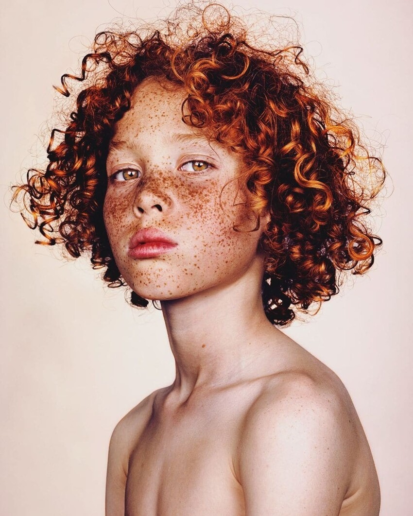 Фотограф делает портреты людей с веснушками, доказывая, что эта особенность — изюминка, а не недостаток