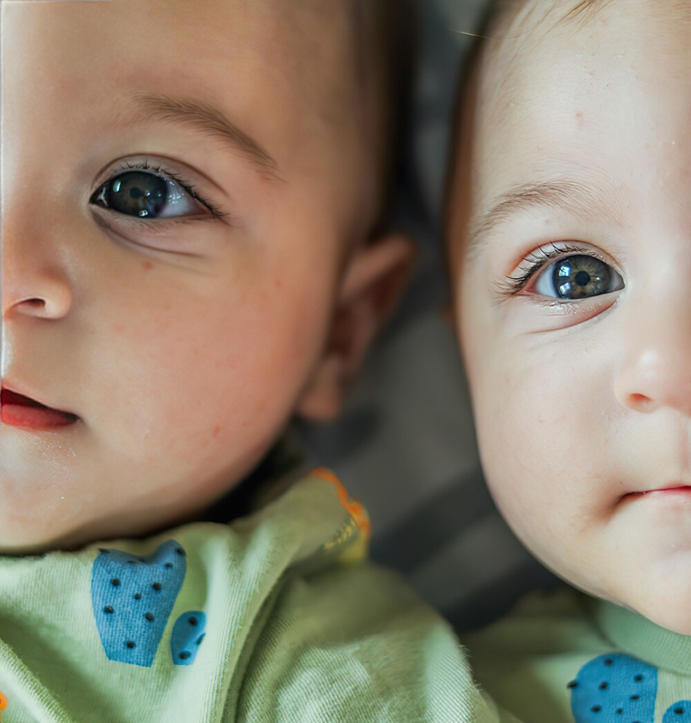 9. Самый длинный промежуток времени между рождением двух близнецов составляет 87 дней