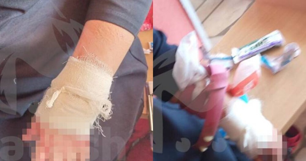В Башкирии школьница устала от травли и порезала двух одноклассниц кухонным ножом