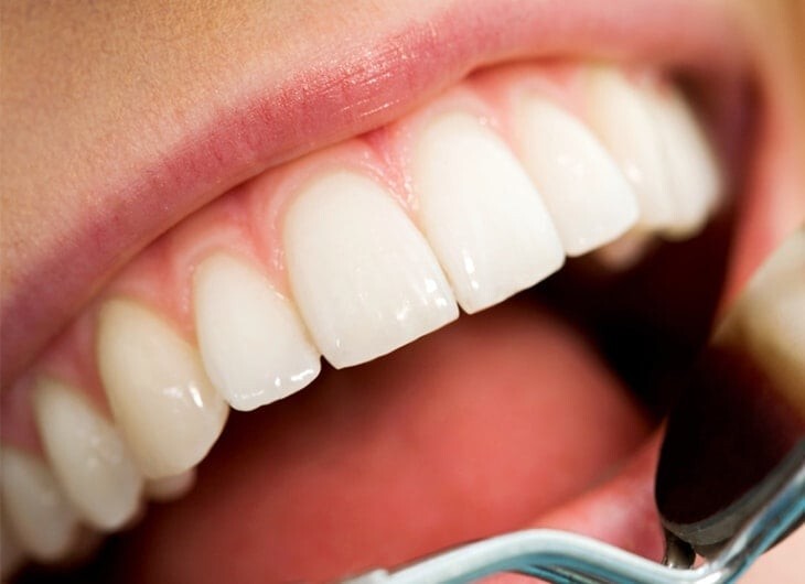 8. Зубы - единственная часть человеческого организма, которая не способна к заживлению и самовосстановлению