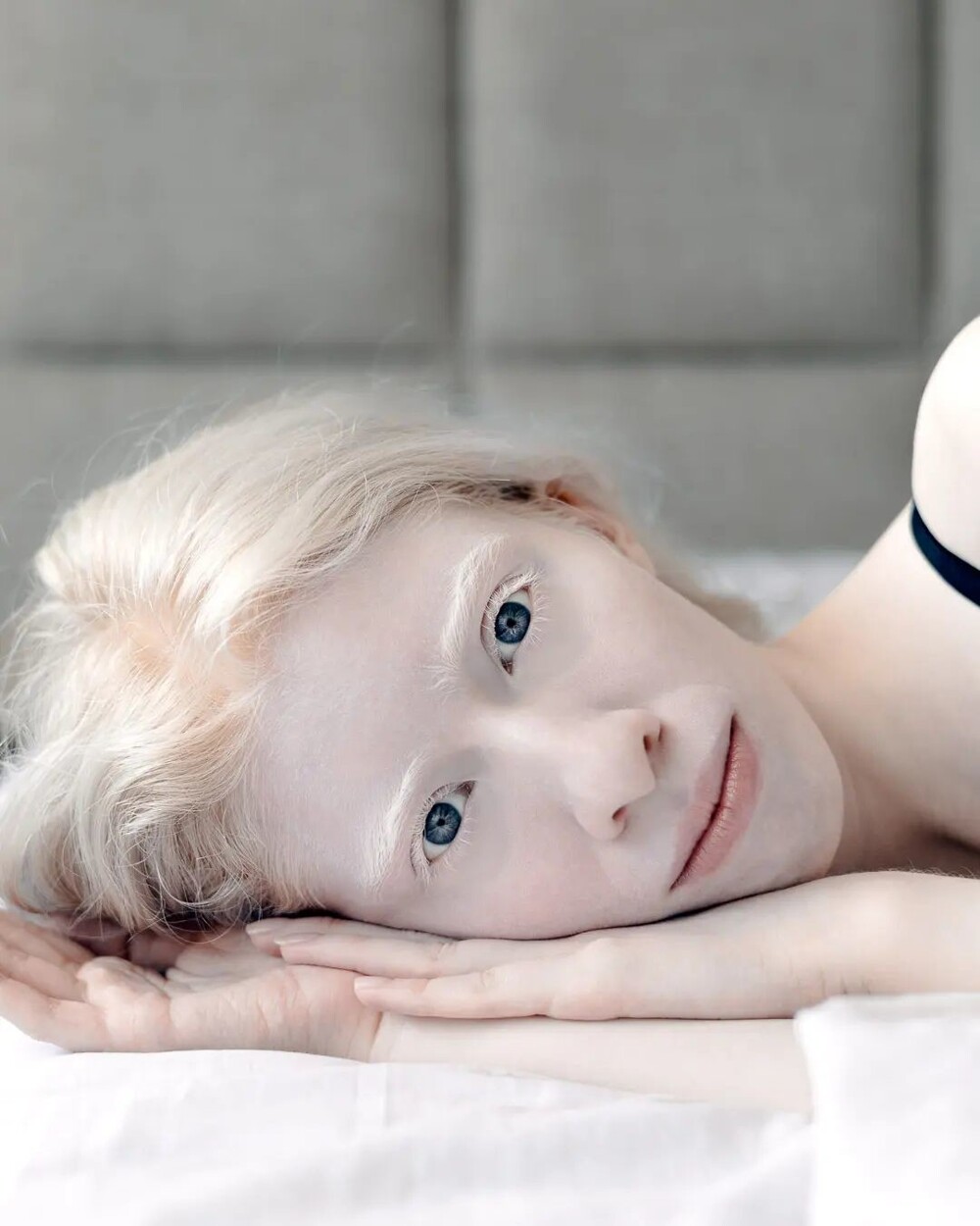 7. Поэтому вечный спутник альбиносов - солнцезащитный крем