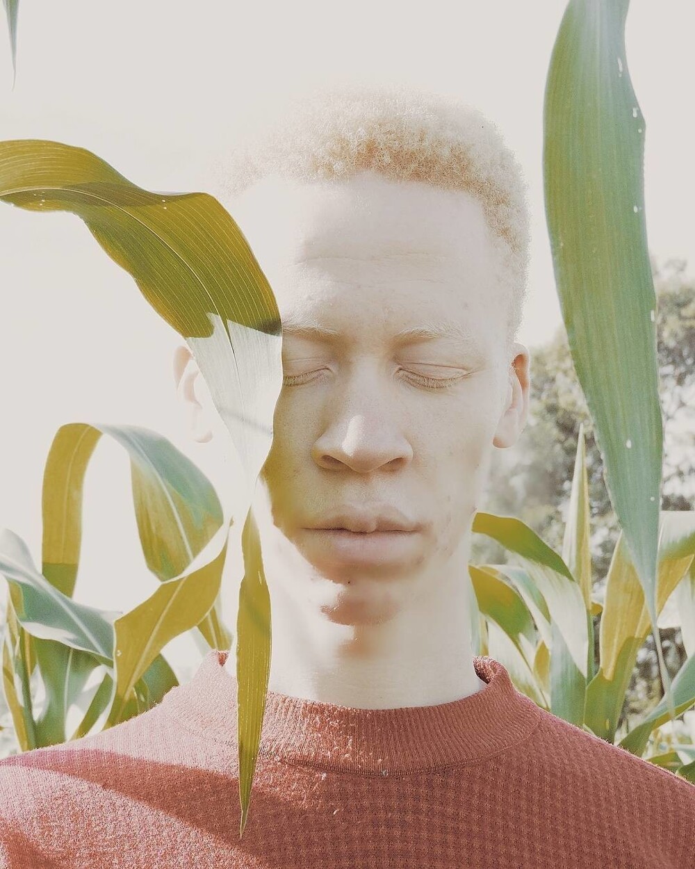 9. Причём альбинизм может быть у представителя любой этнической группы