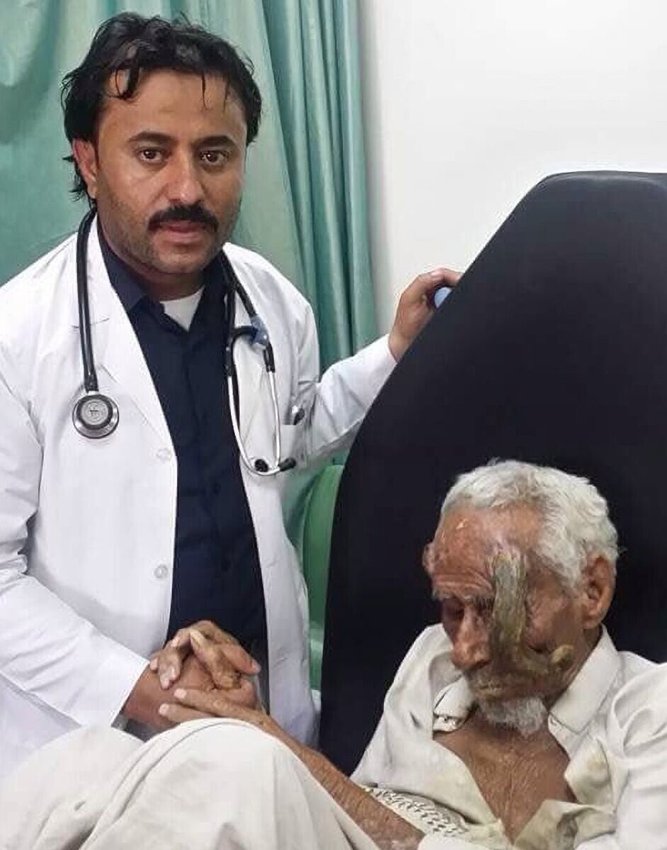 140-летний йеменец умер после удаления рогов. Говорят, они выросли после сделки с Дьяволом