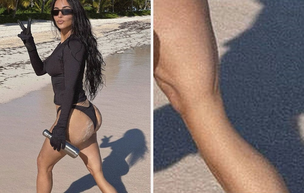 9. Ким Кардашьян пришлось удалить это фото после насмешек фанатов над ее резиновой ногой