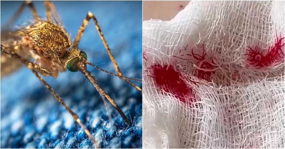 В Волгограде комар заразил мужика червяком