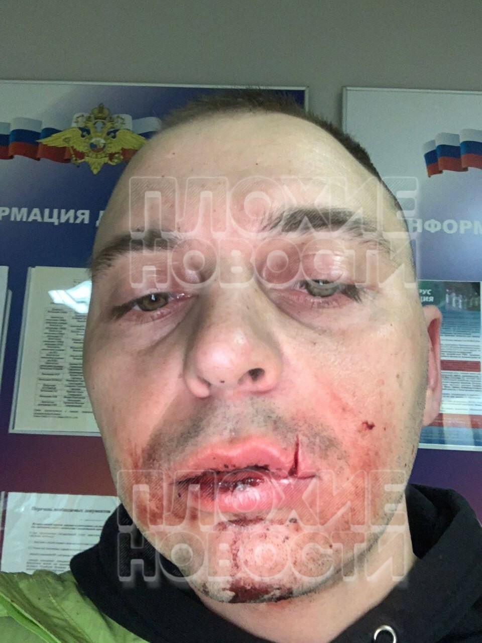 В Петербурге мужчину избили за просьбу выгуливать бойцовскую собаку в наморднике