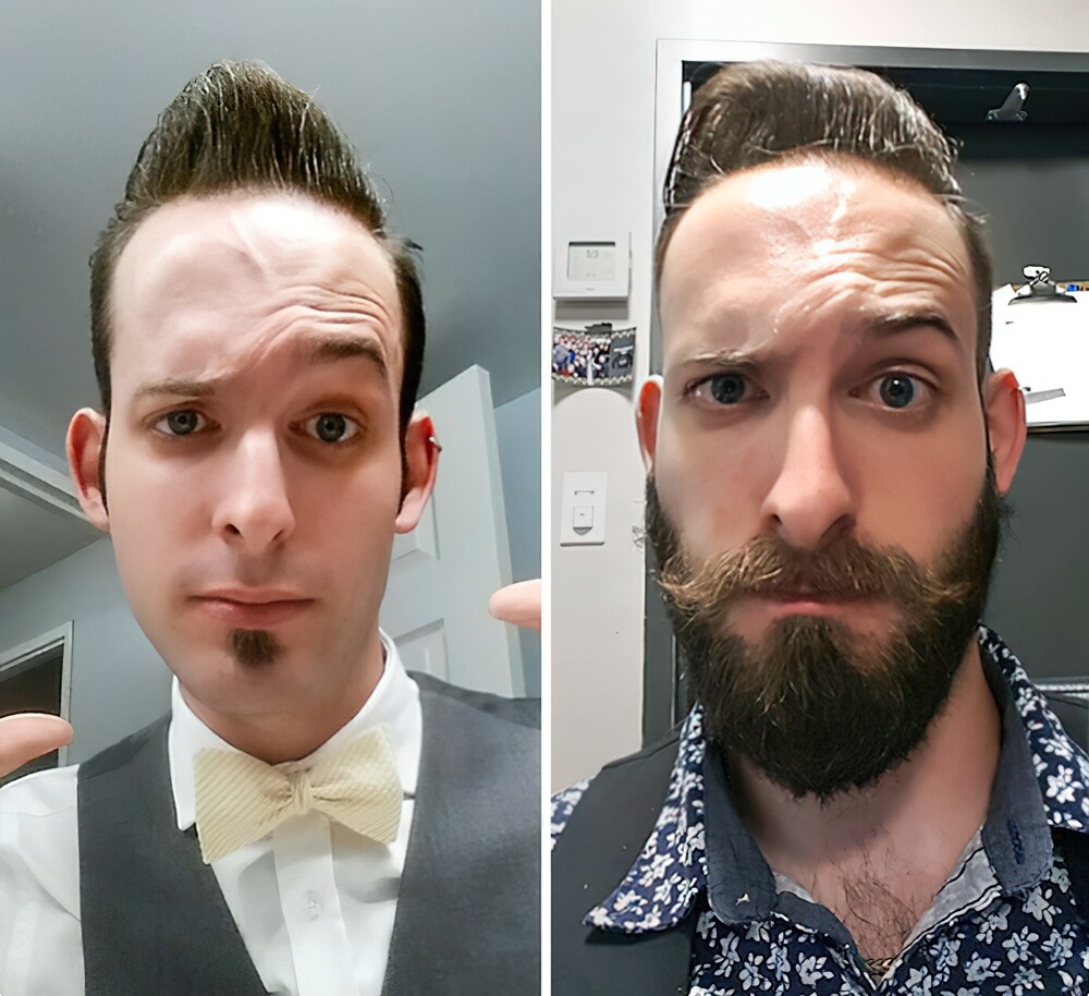 17. «До и после того, как я отрастил бороду. Разница между фотографиями — два месяца»