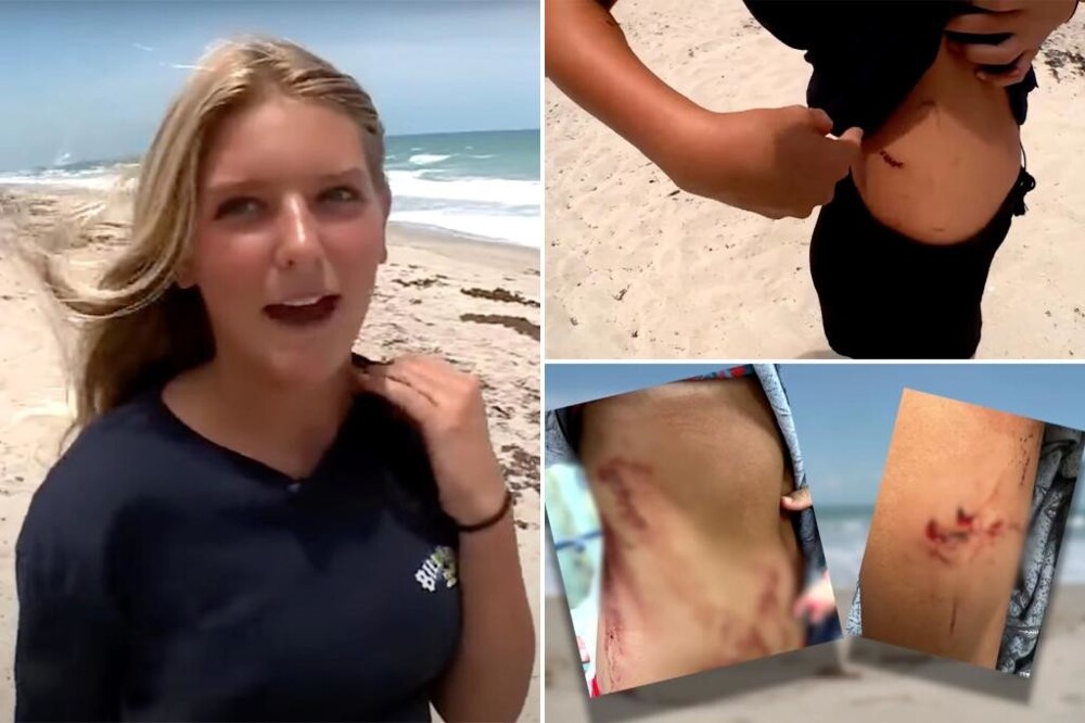 13-летняя американка жестоко избила маленькую акулу
