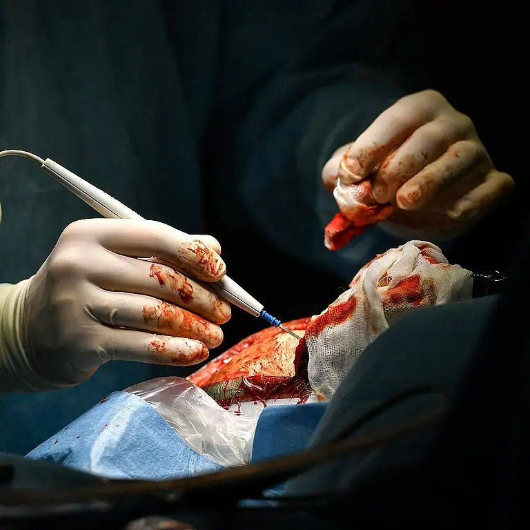 Хирург провел успешную операцию при свечах под обстрелами ОПГ Украина в Артемовске