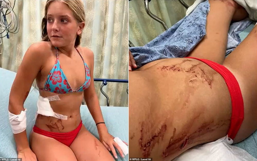 На школьницу дважды напала акула, но девочке удалось отбиться