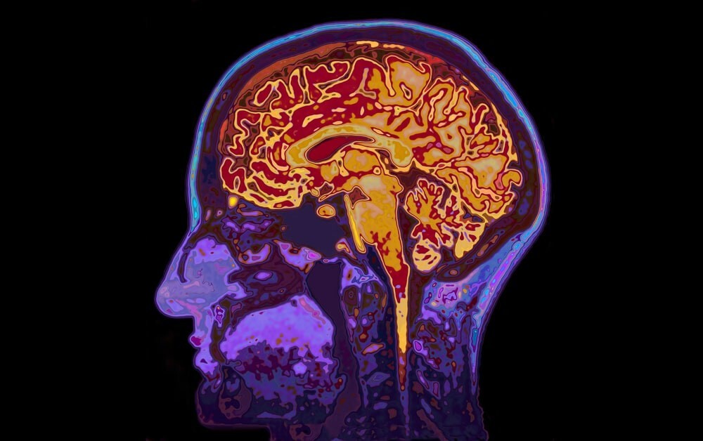 10 любопытных фактов о нашем мозге
