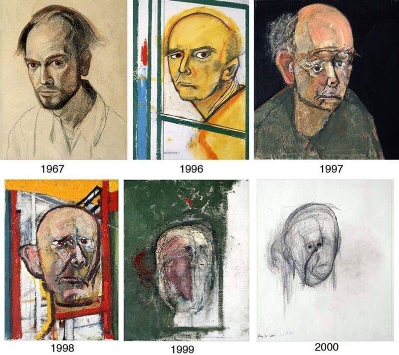 Эволюция развития болезни на примере автопортретов