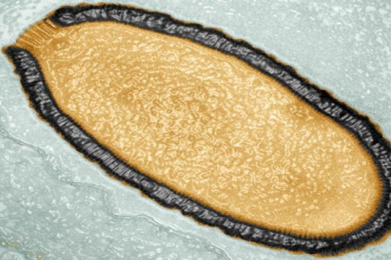 В 2000 году ученые нашли в вечной мерзлоте в Сибири гигантский древний вирус