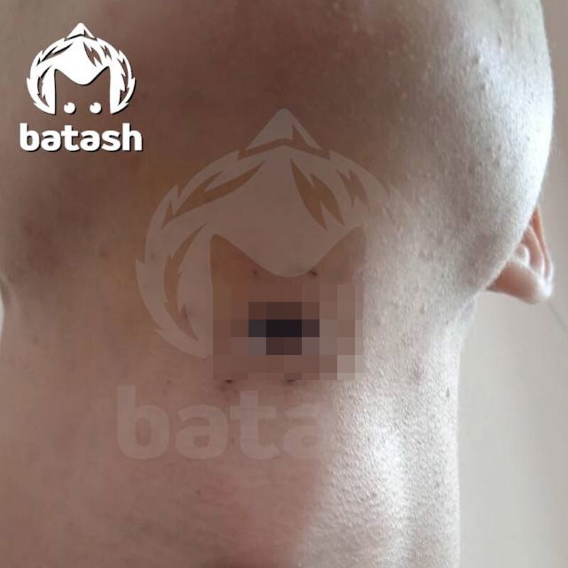 Подросток из Башкирии 2 дня жил с застрявшей во рту пулей