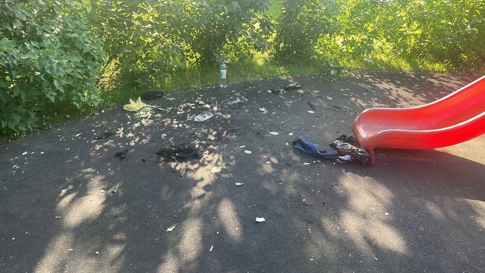 В Москве на детской площадке едва не сгорел заживо 14-летний подросток
