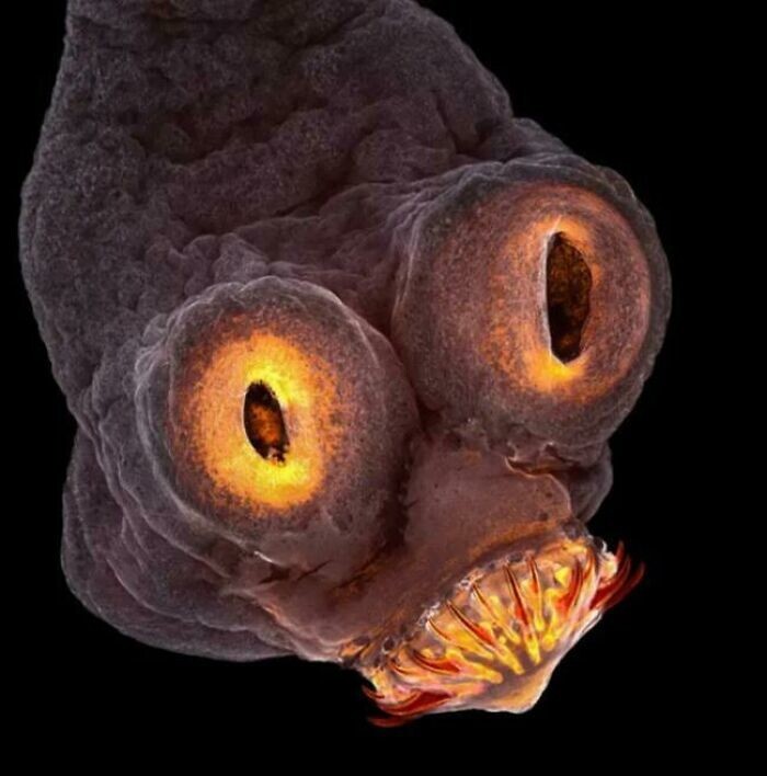 14. Голова ленточного червя под микроскопом