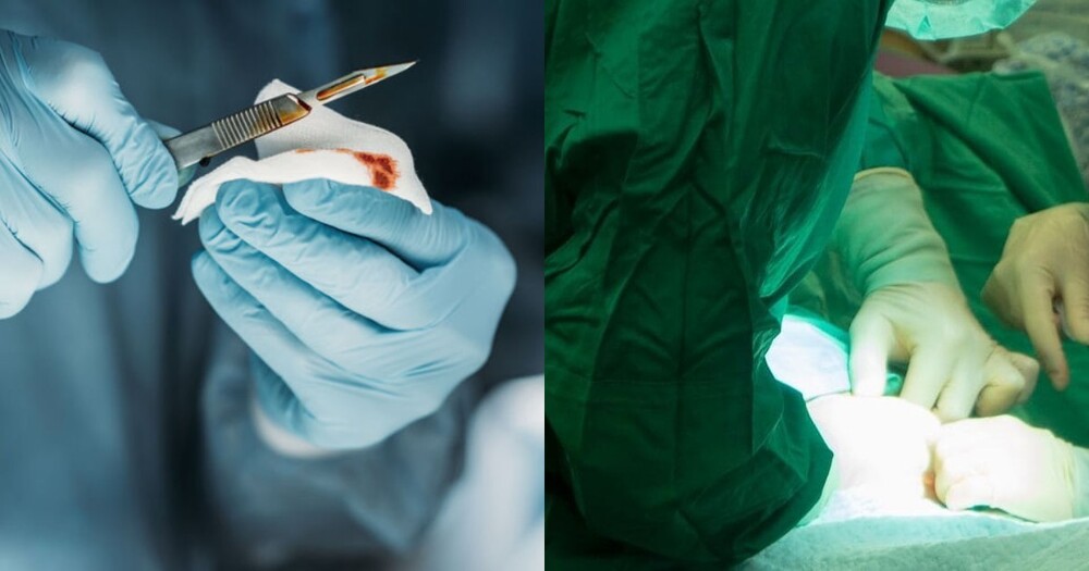 Хирурги из Сочи забыли в теле пациентки скальпель, который обнаружили через несколько месяцев