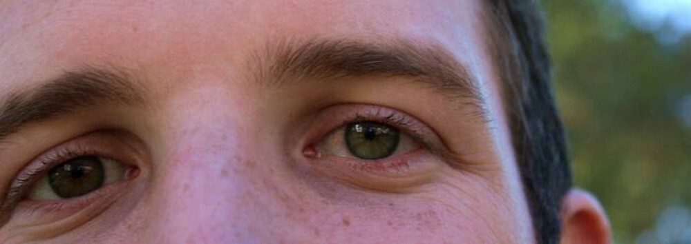 19. «Я амбидекстр, и у меня гетерохромия. Один глаз зеленый, второй карий»