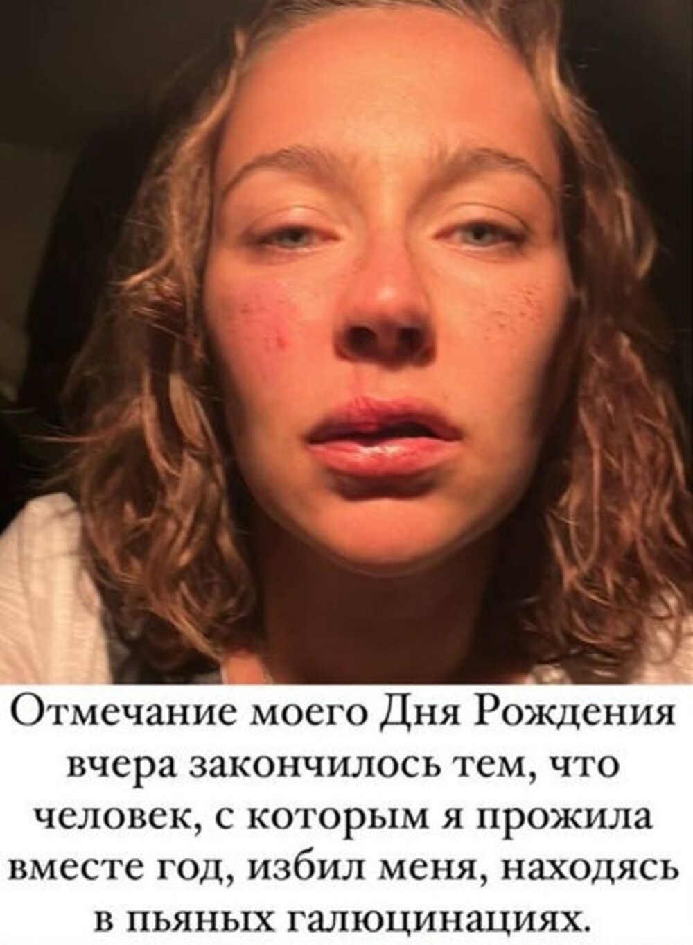 Уехавшую из России на Бали актрису и ведущую программы «Измены» избил её сожитель. За неверность