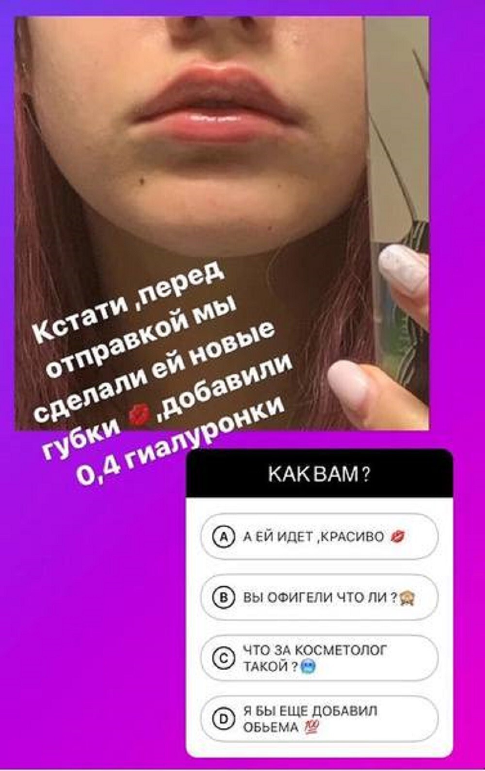 Дана Борисова похвасталась в социальных сетях тем, что увеличила 15-летней дочери губы