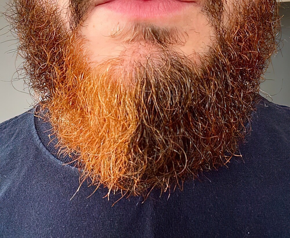 5. Двухцветная борода, половина тёмно-рыжая, половина ярко-рыжая