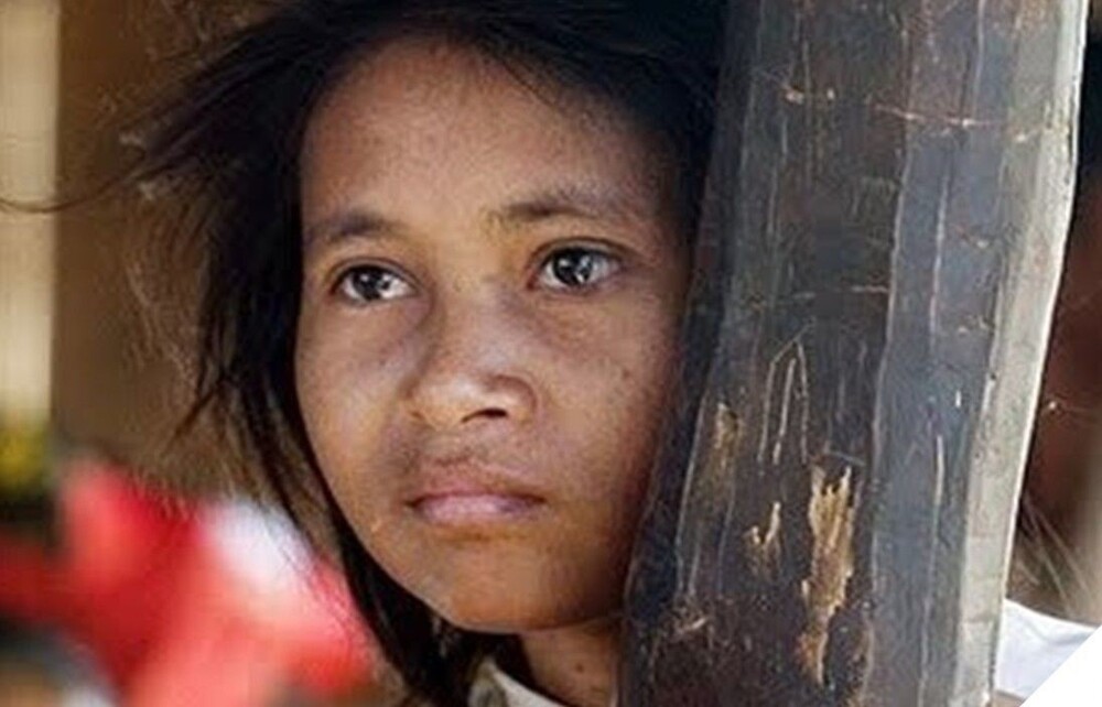 Печальная история камбоджийской девушки-обезьянки