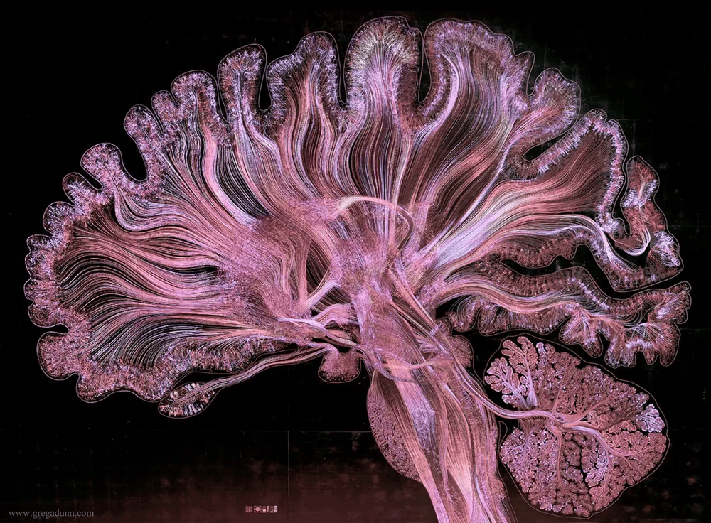14 фото работы мозга, которые показывают, как выглядит то, что происходит у нас в голове