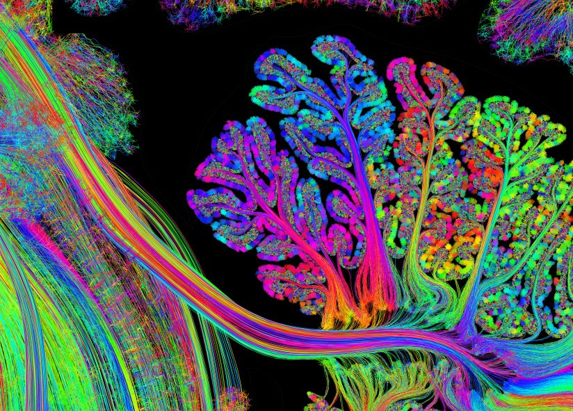 14 фото работы мозга, которые показывают, как выглядит то, что происходит у нас в голове