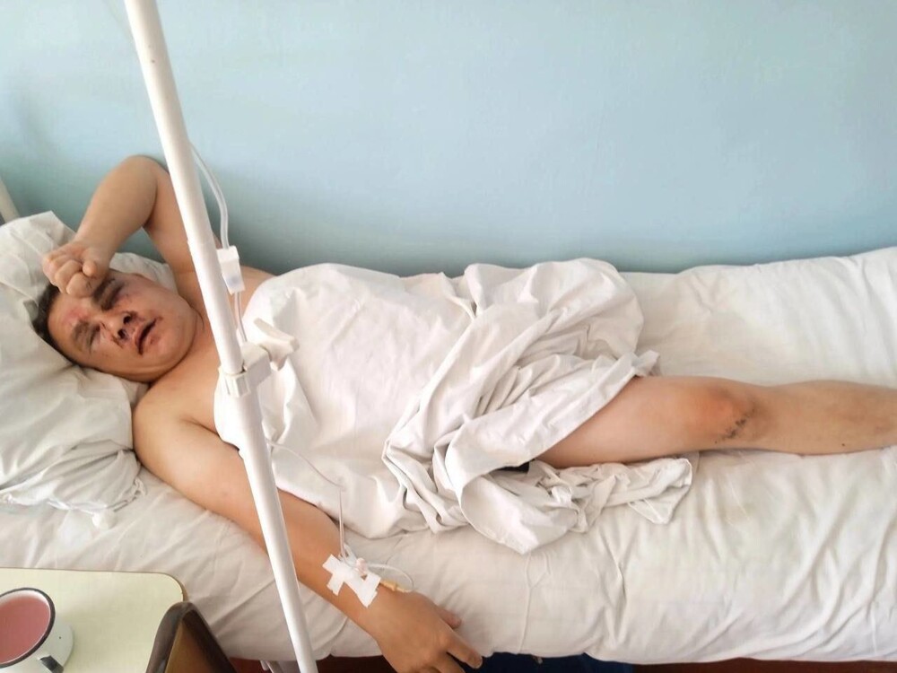 В Забайкалье избили участника СВО, потерявшего в бою ногу